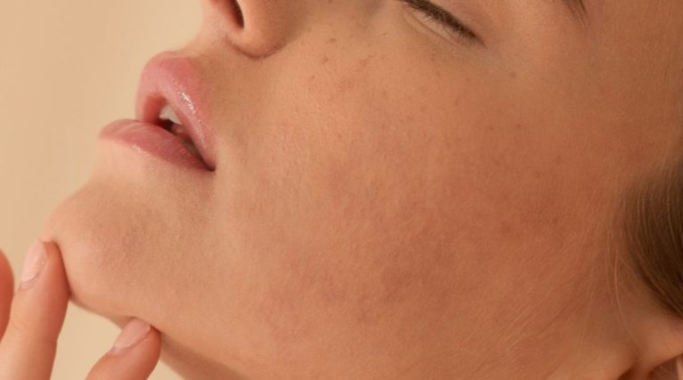 Gıdı Vaser Lipo kıbrıs