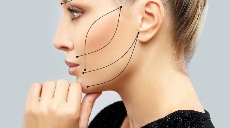 Thread Lift kıbrıs