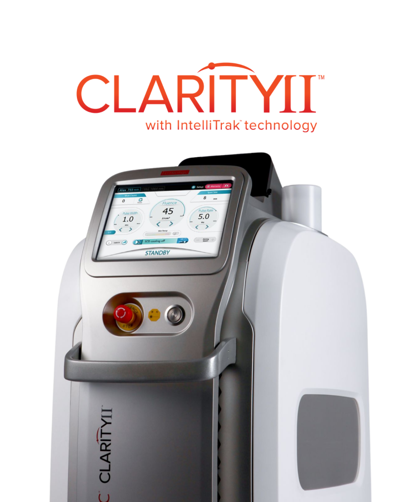 Clarity <em>II</em>